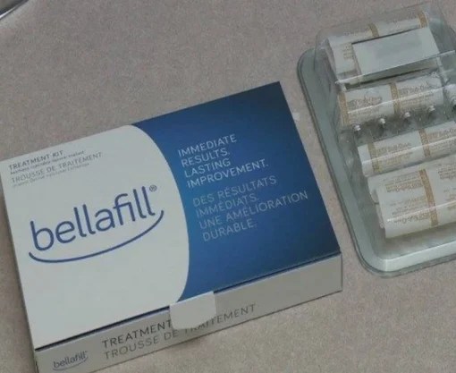 bellafill dermal filler