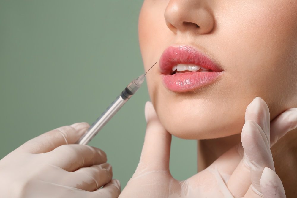 dermal fillers