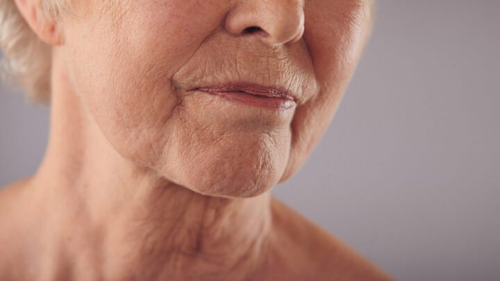 skinboosters before and after
